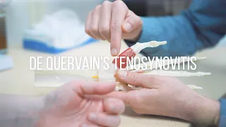 De Quervain's Tenosynovitis