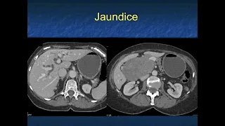 You Make the Call! Freestyle Radiology Quiz #13