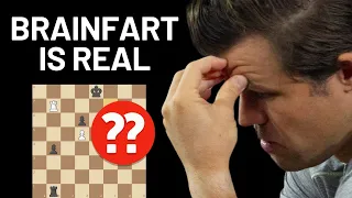 SHOCKING Blunder Decides Carlsen Vs So Chess Finals (Champions Chess Tour, Set 1)