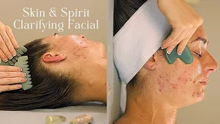 Clarifying Acne Facial: Natural Rituals for Clear Skin + Spirit Care