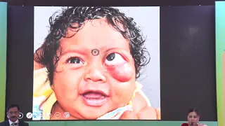 AIOC2020 GP066 T1 Dr  Santosh Honavar Orbital surgeries   Basics