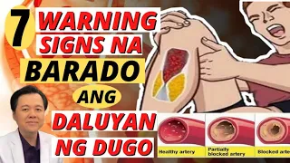 7 Warning Signs na Barado ang Daluyan ng Dugo - Payo ni Doc Willie Ong #1363