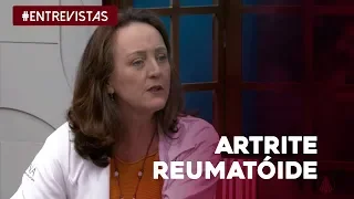 Tudo o que você precisa saber sobre a artrite reumatoide