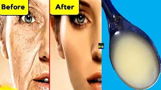 Apply This Mask In 5 Minutes - Remove Wrinkles And Dark Spots On The Face Naturally At Home