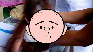Orangutan Medical Checkup (Pilky Clips)