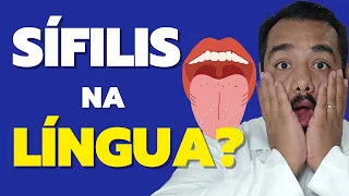 Sífilis na boca ou língua existe? Quais os sintomas? Como se pega? | Prof. Dr. Victor Proença