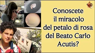 Conoscete il miracolo del petalo di rosa del Beato Carlo Acutis?