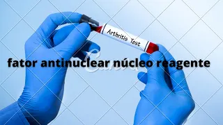fator antinuclear núcleo reagente