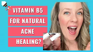 Vitamin B5 and acne - HORMONAL ACNE TREATMENT?