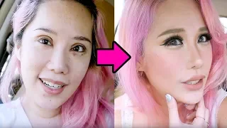 Eyelid & Nose plastic surgery w Dr Martin Huang Recovery part 2: See the healed results!