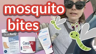 How to fade mosquito bites and stop the itch | Dr Dray