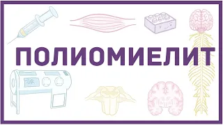 Полиомиелит - причины, симптомы, диагностика, лечение, вакцины