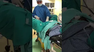 Cystoscope procedure #shortsvideo #anesthesiamachine #shortsyoutube # #shortvideos #viralvideo