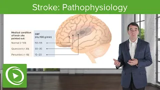 Stroke: Pathophysiology | Clinical Neurology