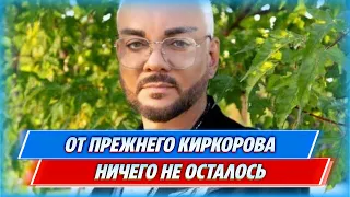 Киркоров после тотальной пластики появился на людях