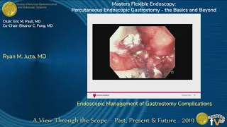 Endoscopic Management of Gastrostomy Complications
