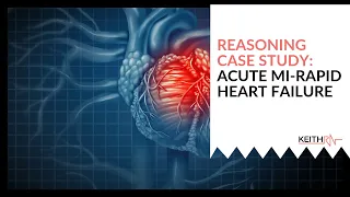 Acute MI-RAPID Reasoning Case Study