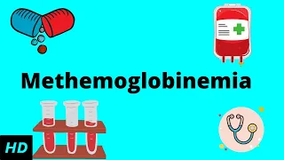 Methemoglobinemia, Causes, SIgns and Symptoms, Diagnosis and Treatment.