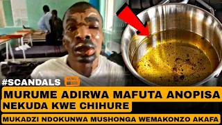 Murume uyu abatwa achihura akapiswa nemafuta nemukadzi wake. Mukadzi akazviuraya nemushonga wemakonz