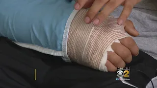 Elementary School Student Blames Teacher For Broken Arm