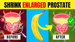 Top 8 Fruits to Shrink an Enlarged Prostate