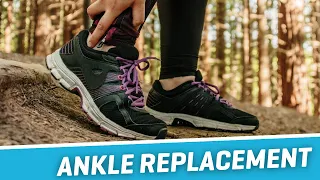 Should you have an ankle replacement surgery!?