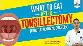 Recommended Diet Plan After Tonsil Removal Surgery: What to Eat and What to Avoid