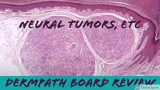 Nerve Sheath Tumors, etc: Dermpath Board Review (25 cases in 1.5 hours) for Dermatology & Pathology