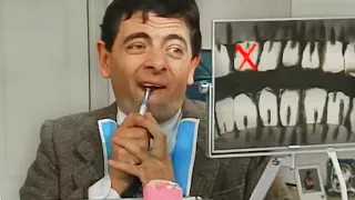 Mr Bean fixes His Own Teeth! | Mr Bean live Action | Full Episodes | Mr Bean