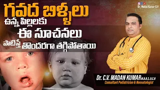 Mumps in Telugu /గవద బిళ్ళలు/Mumps in children /Dr Madan Kumar cv