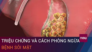 Bệnh sỏi mật: Triệu chứng và cách phòng ngừa | VTC Now