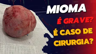 Mioma no útero é perigoso?