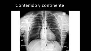 evaluacion de radiografia de torax