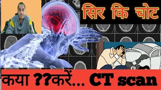 Head Injury यानी सिर पर चोट लग जाए तो ये गलती जान ले सकती है सिर मे चोट लगने पर क्या करें (हिंदी मे)