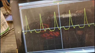 Pressure Transducer Update.