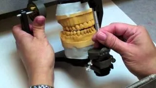 Occlusion Laboratory Video Guides Video 4 Setting Up Articulator for Waxing