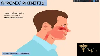 CHRONIC RHINITIS (Simple chronic rhinitis, hypertrophied rhinitis & atrophic rhinitis)