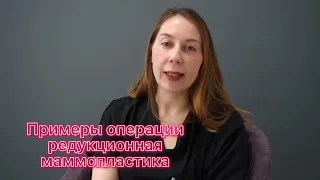 «Редукционная маммопластика» - разбор самых важных тем