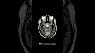 Creepy MRI Images EXPLAINED 😱 (spooky)