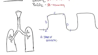 Capnography