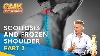 Scoliosis and Frozen Shoulder (Part 2) | Usapang Pangkalusugan