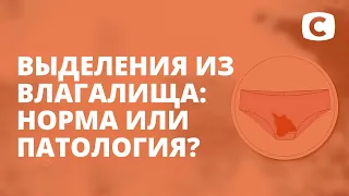 Выделения у женщин: норма и патология – Я стесняюсь своего тела