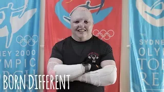 The Weightlifter With Butterfly Skin | BORN DIFFERENT