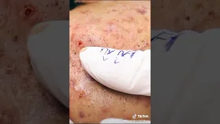 Acne 2021 Relax Video 4K