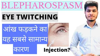 आँखों का फड़कना : कारण और इलाज |Eye twitching: Causes and Treatment in Hindi आँख फड़कना शुभ या अशुभ