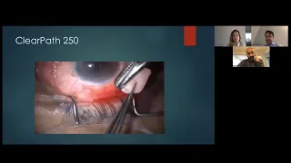 Lecture: Point-2-Point with Dr. Malik Y. Kahook - Glaucoma Drainage Devices: Tips and Tricks