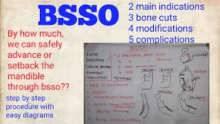 BSSO