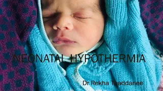 Neonatal Hypothermia | Pediatrics