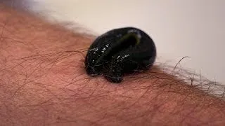 Michael Mosley is bitten by a leech - Infested! Living with Parasites - BBC Four