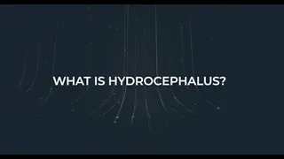 About Hydrocephalus